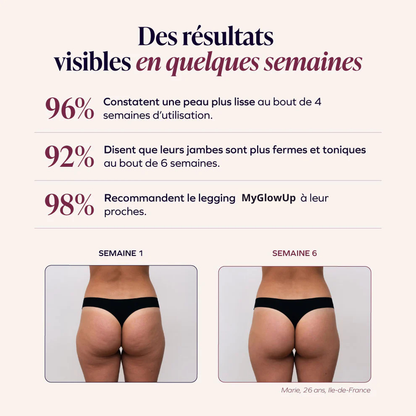 Legging 3D - Anti-Cellulite